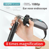JIUTAN  Ear Endoscope Camera Endoscopy Rigid Portable 1080p Endoscopic 0 30 70 Degree Flexible Nasal Nose Medical ENT Endoscope